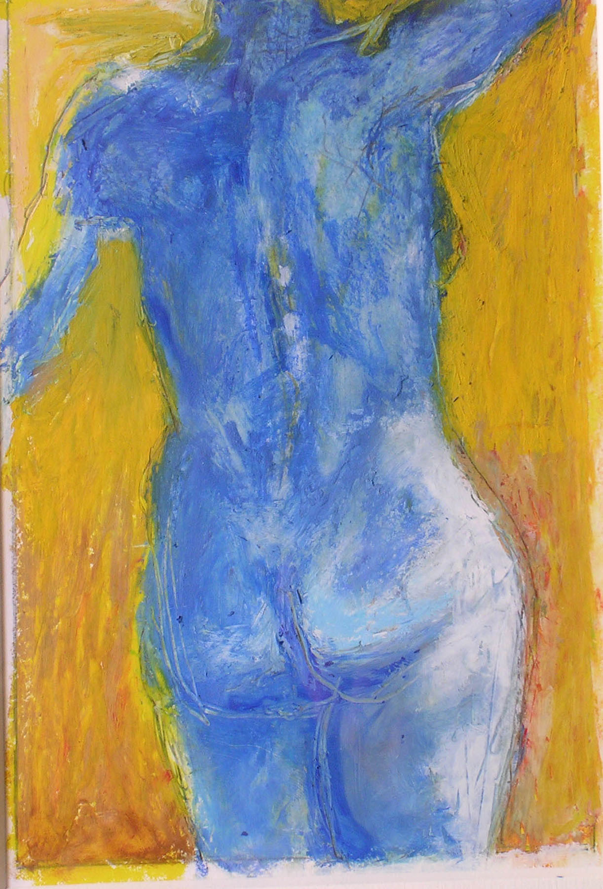 Figure XI
